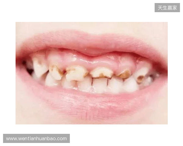 韦林顿确诊上唇部贯通伤；11、21牙半脱位；上颌前牙区牙槽骨骨折